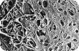 SLT_400Mm-B_W Electron microscopy of TM after SLT
