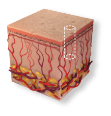 skin2 DeepFX - deep penetration pulse profile