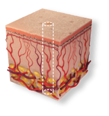 skin4 SCAARFX penetration profile - deepest penetration in a single pulse