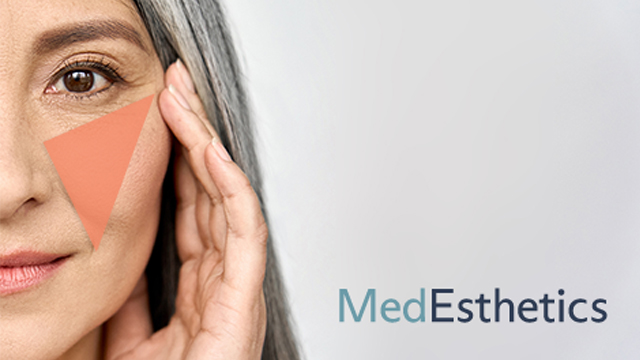 a woman is touching her face – medesthetics.