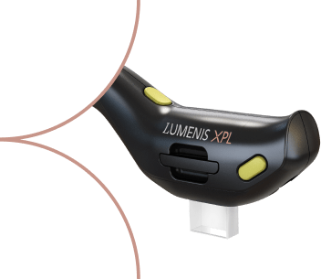 xpl-handpiece