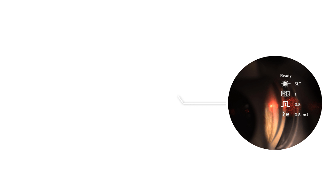 focus-lightbox